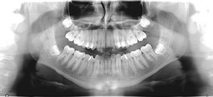 radiologia_2